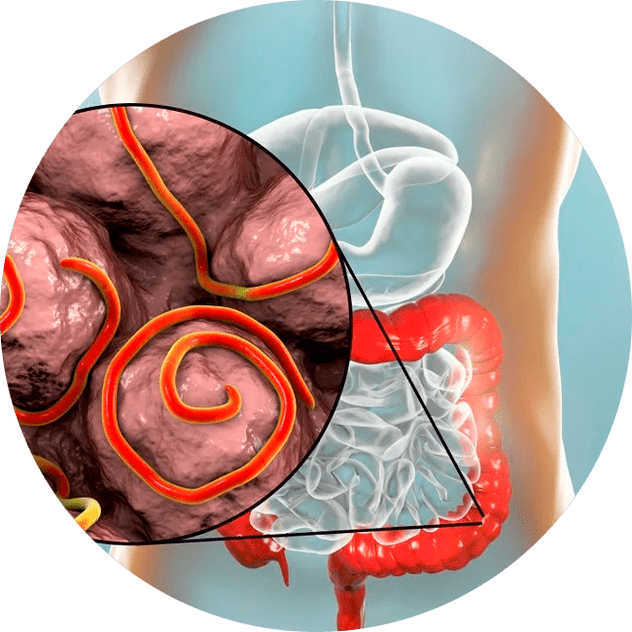 Стомашно-чревен тракт и паразити