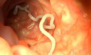 причини за паразити в човешкото тяло